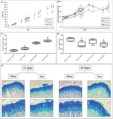 Different Effects of Soy and Whey on Linear Bone Growth and Growth Pattern in Young Male Sprague-Dawley Rats